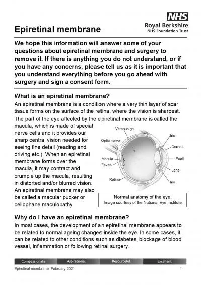 Epiretinal membraneFebruary 2021