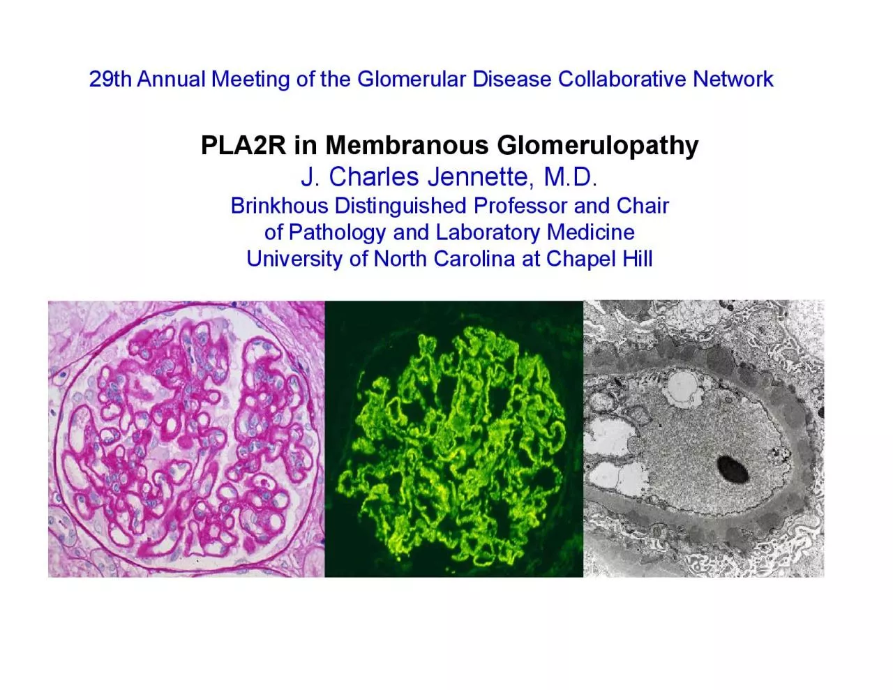 PDF-29th Annual Meeting of the Glomerular Disease Collaborative NetworkPLA