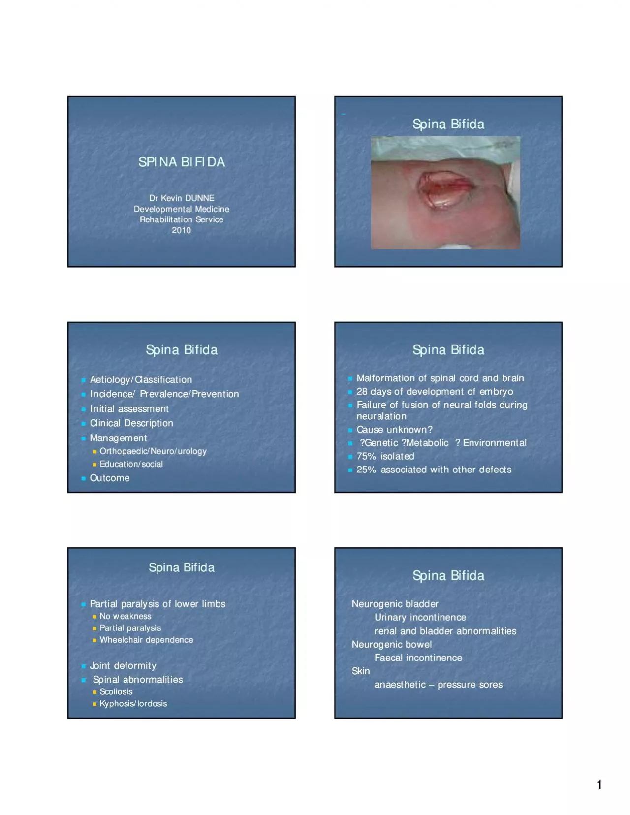 PDF-SPINA BIFIDASPINA BIFIDA