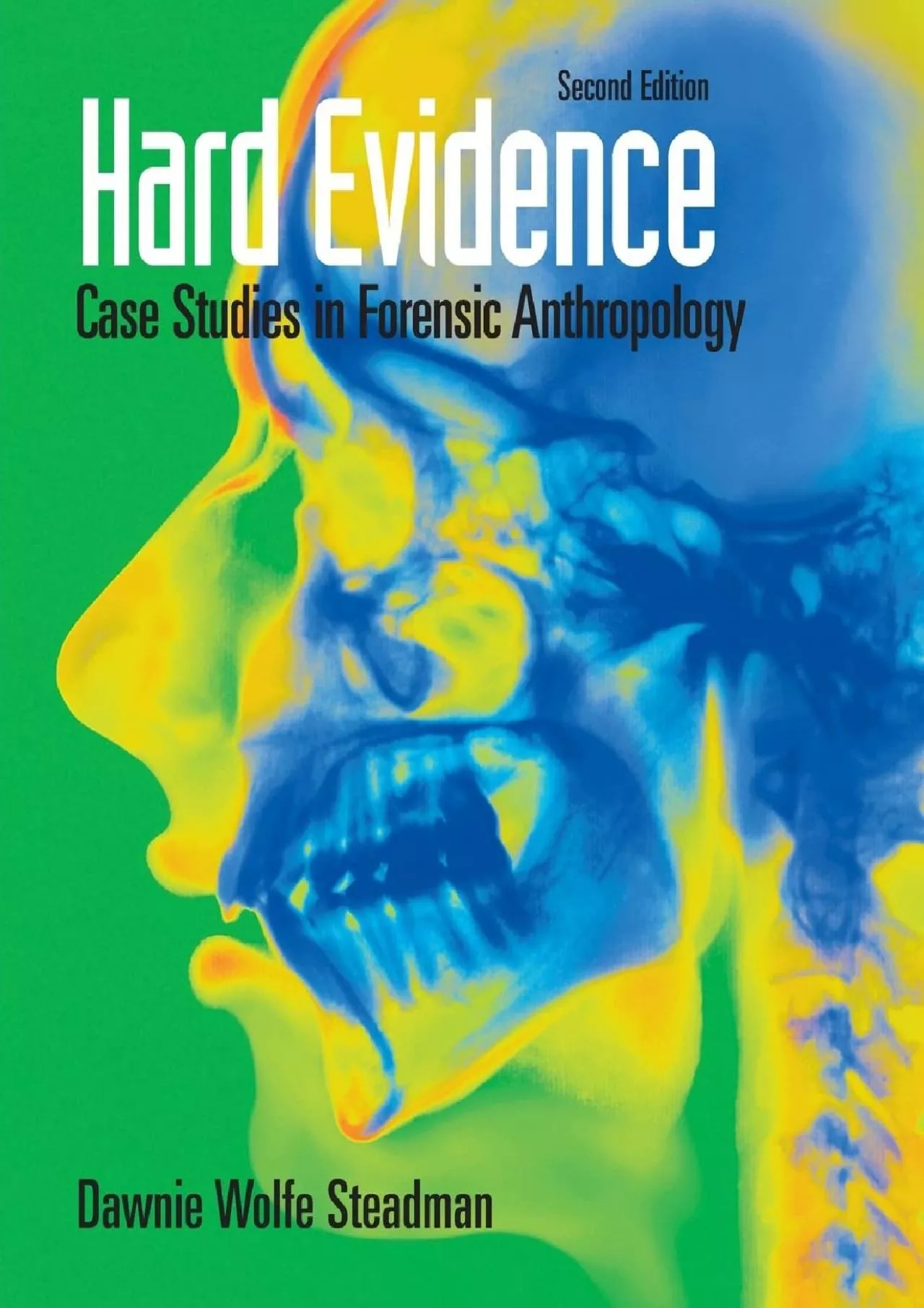 PDF-(EBOOK)-Hard Evidence: Case Studies in Forensic Anthropology