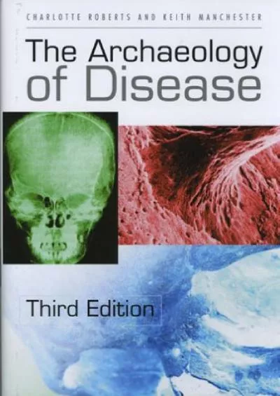(READ)-The Archaeology of Disease