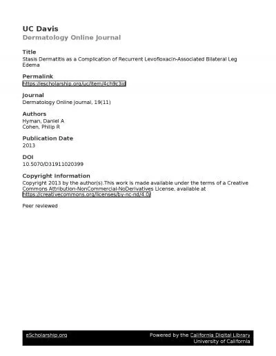 Volume 19 Number 11 November2013Case PresentationStasis Dermatitis asa