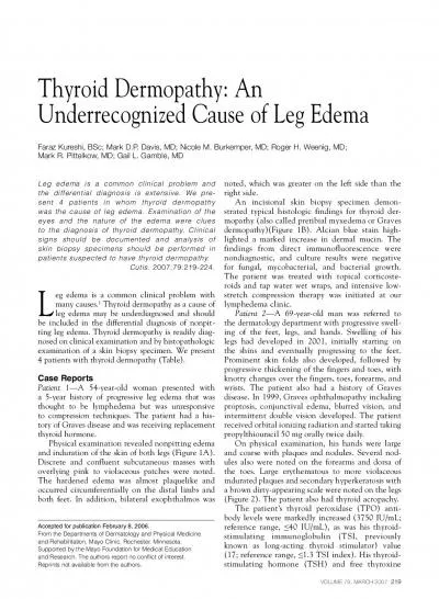 eg edema is a common clinical problem with