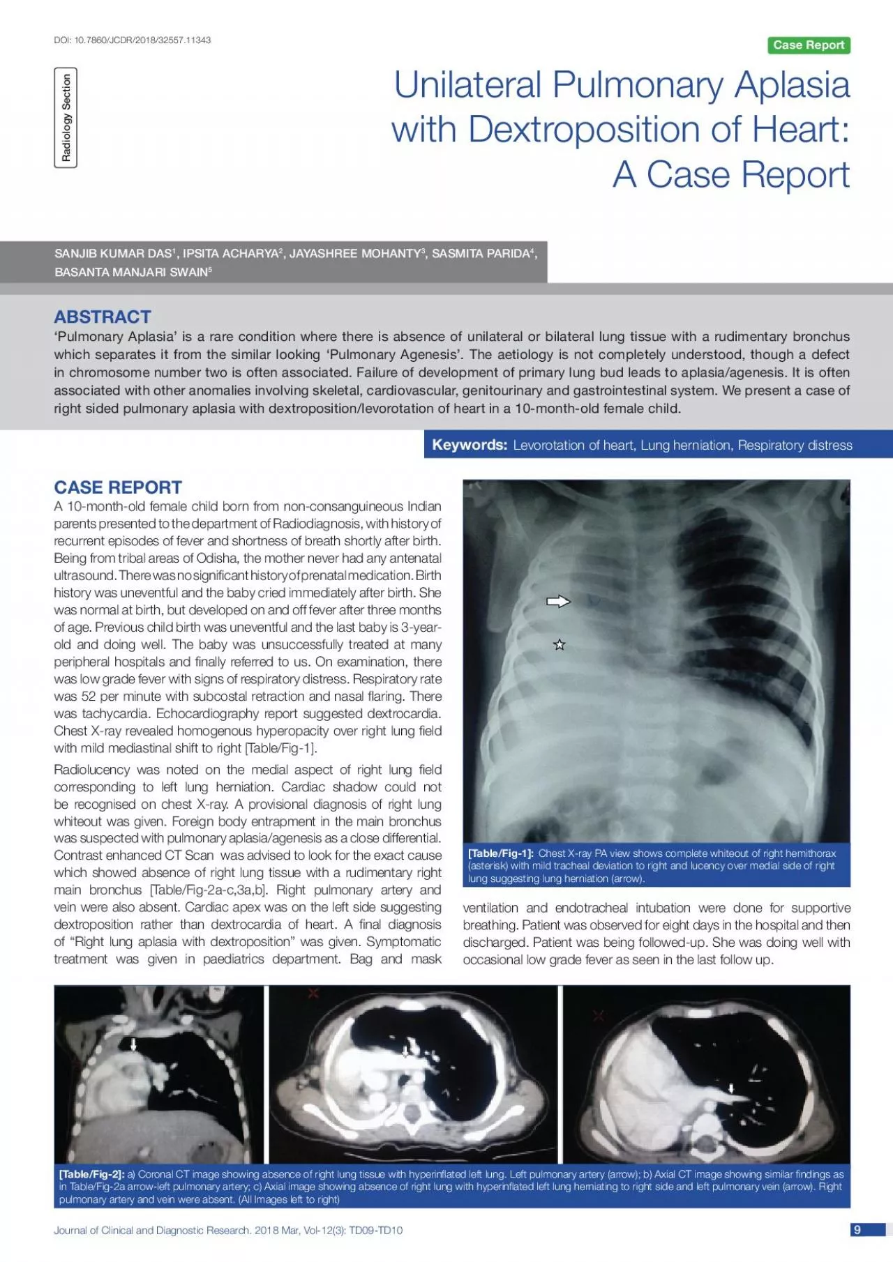 PDF-Journal of Clinical and Diagnostic Research 2018 Mar Vol123 TD09