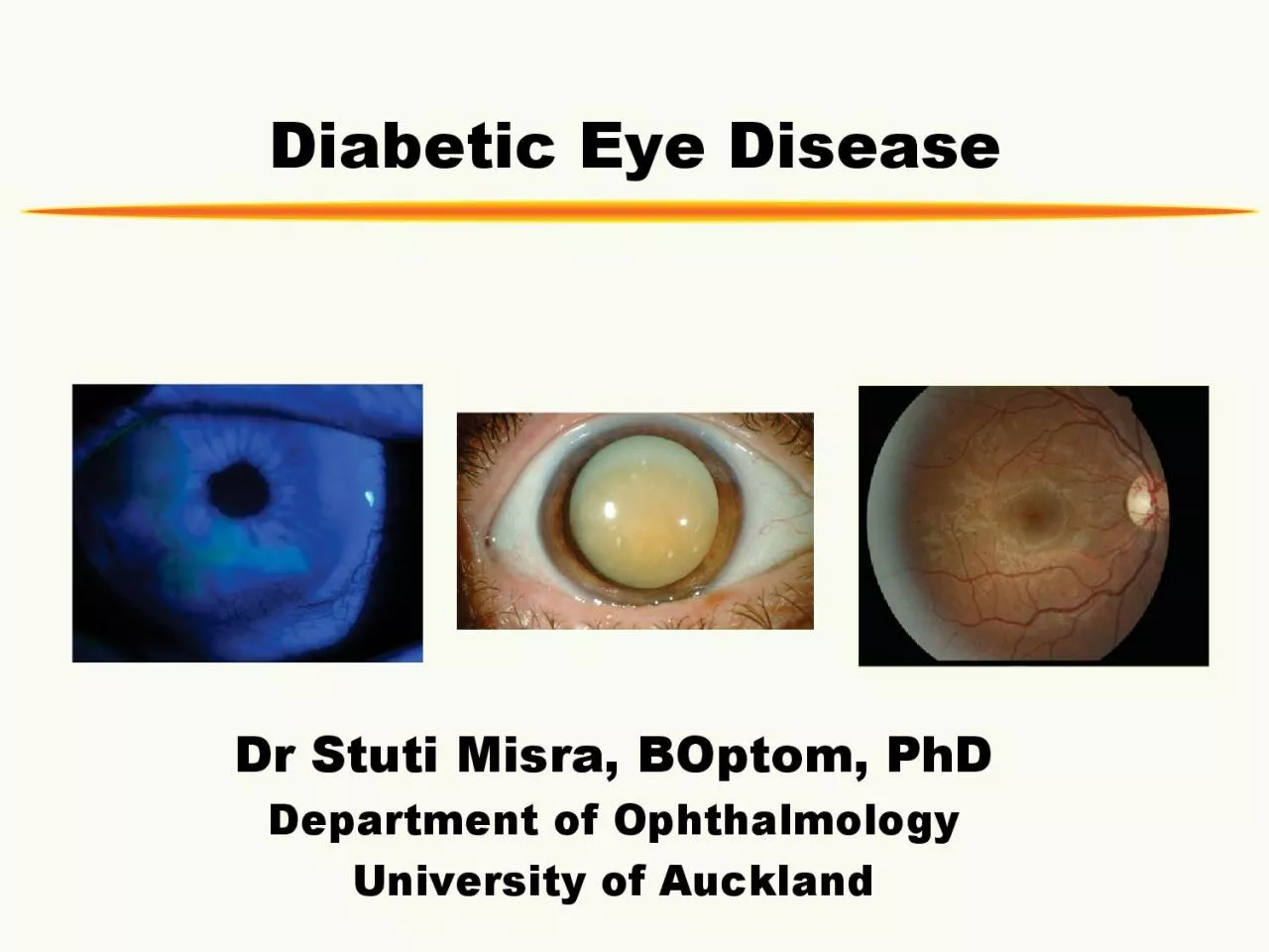 Diabetic Eye DiseaseDr Stuti Misra BOptom PhDDepartment of Ophthalmo