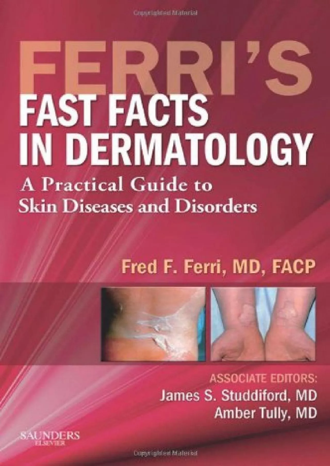 (DOWNLOAD)-Ferri\'s Fast Facts in Dermatology: A Practical Guide to Skin Diseases and