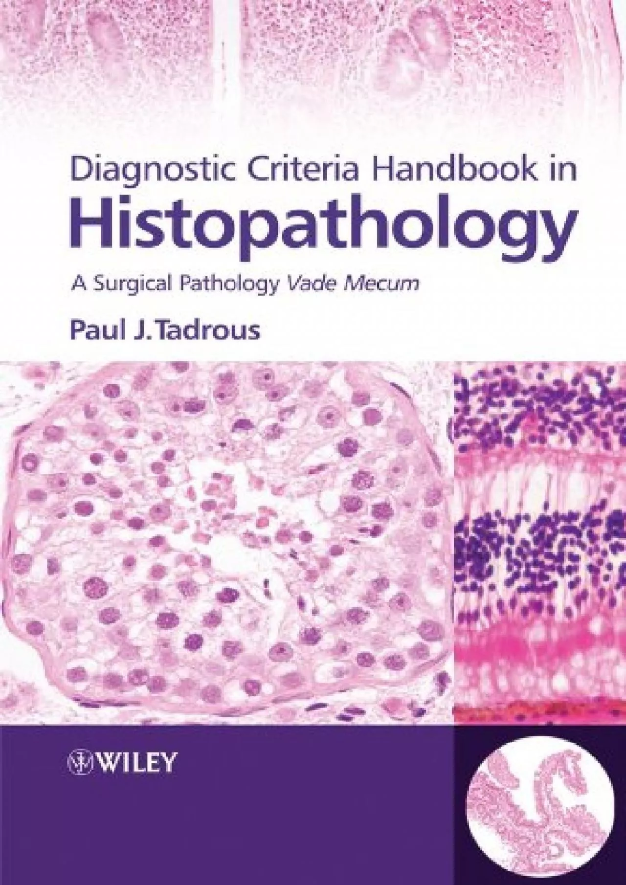 (EBOOK)-Diagnostic Criteria Handbook in Histopathology: A Surgical Pathology Vade Mecum