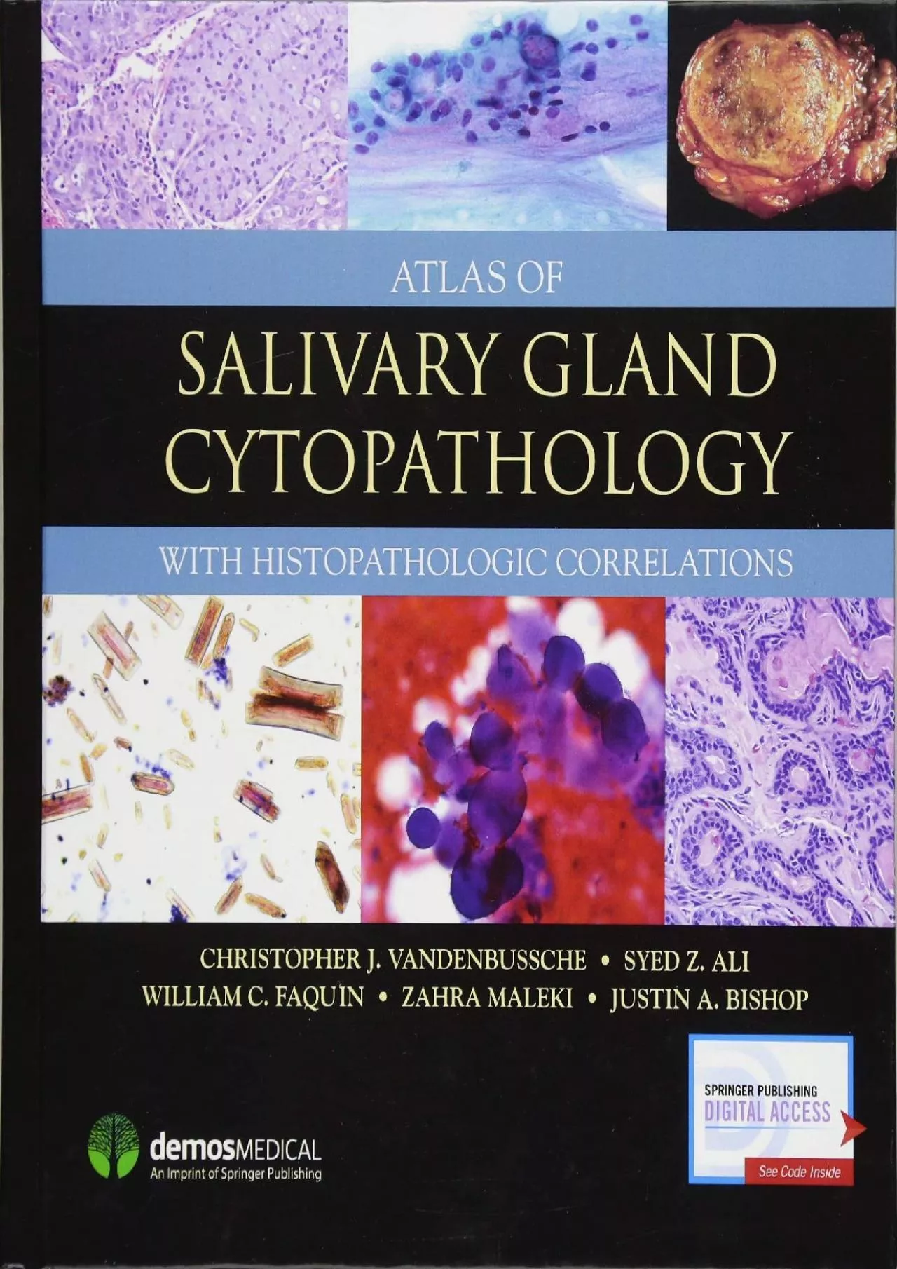 (DOWNLOAD)-Atlas of Salivary Gland Cytopathology: with Histopathologic Correlations