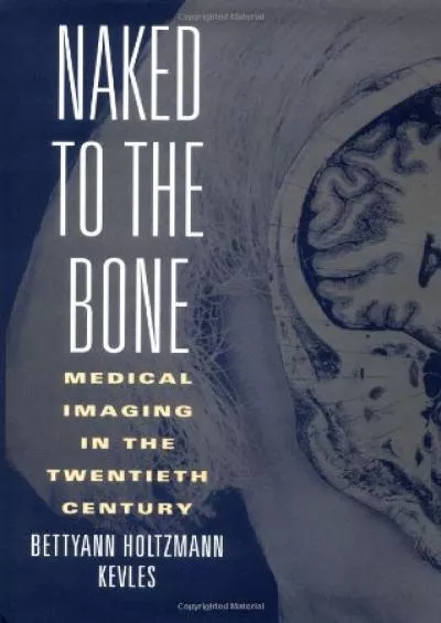 (EBOOK)-Naked to the Bone: Medical Imaging in the Twentieth Century (Sloan Technology Series)