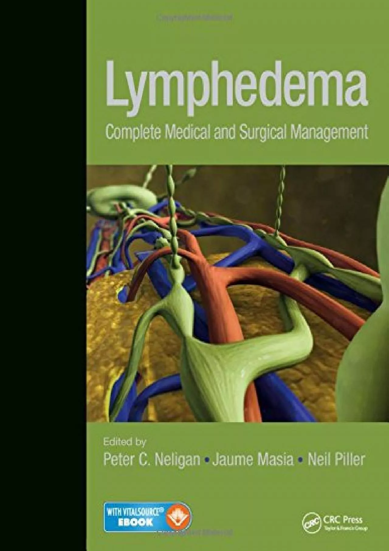 PDF-(EBOOK)-Lymphedema: Complete Medical and Surgical Management