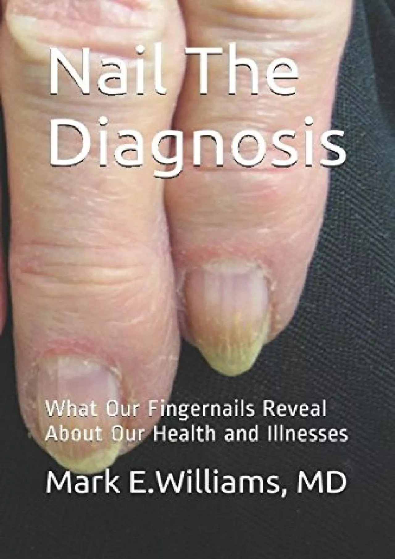 PDF-(BOOK)-Nail The Diagnosis: What Our Fingernails Reveal About Our Health and Illnesses