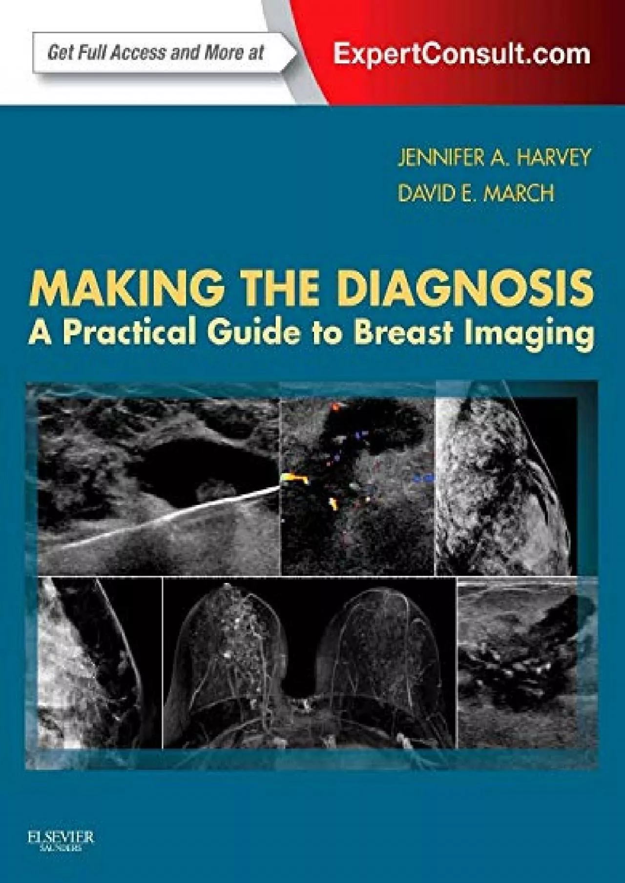 PDF-(DOWNLOAD)-Making the Diagnosis: A Practical Guide to Breast Imaging: Expert Consult -