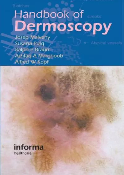 (READ)-Handbook of Dermoscopy