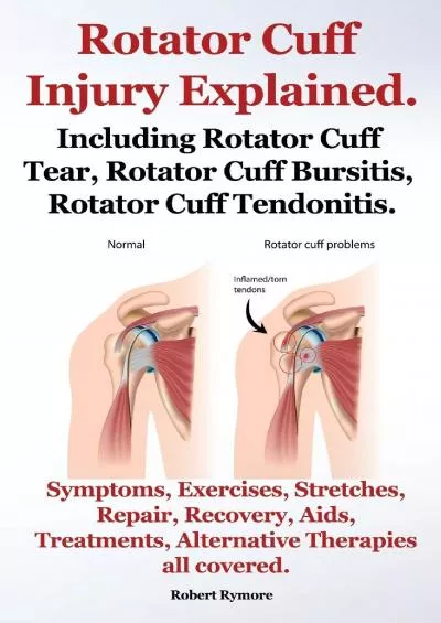 (DOWNLOAD)-Rotator Cuff Injury Explained. Including Rotator Cuff Tear, Rotator Cuff Bursitis, Rotator Cuff Tendonitis. Symptoms, Exer...