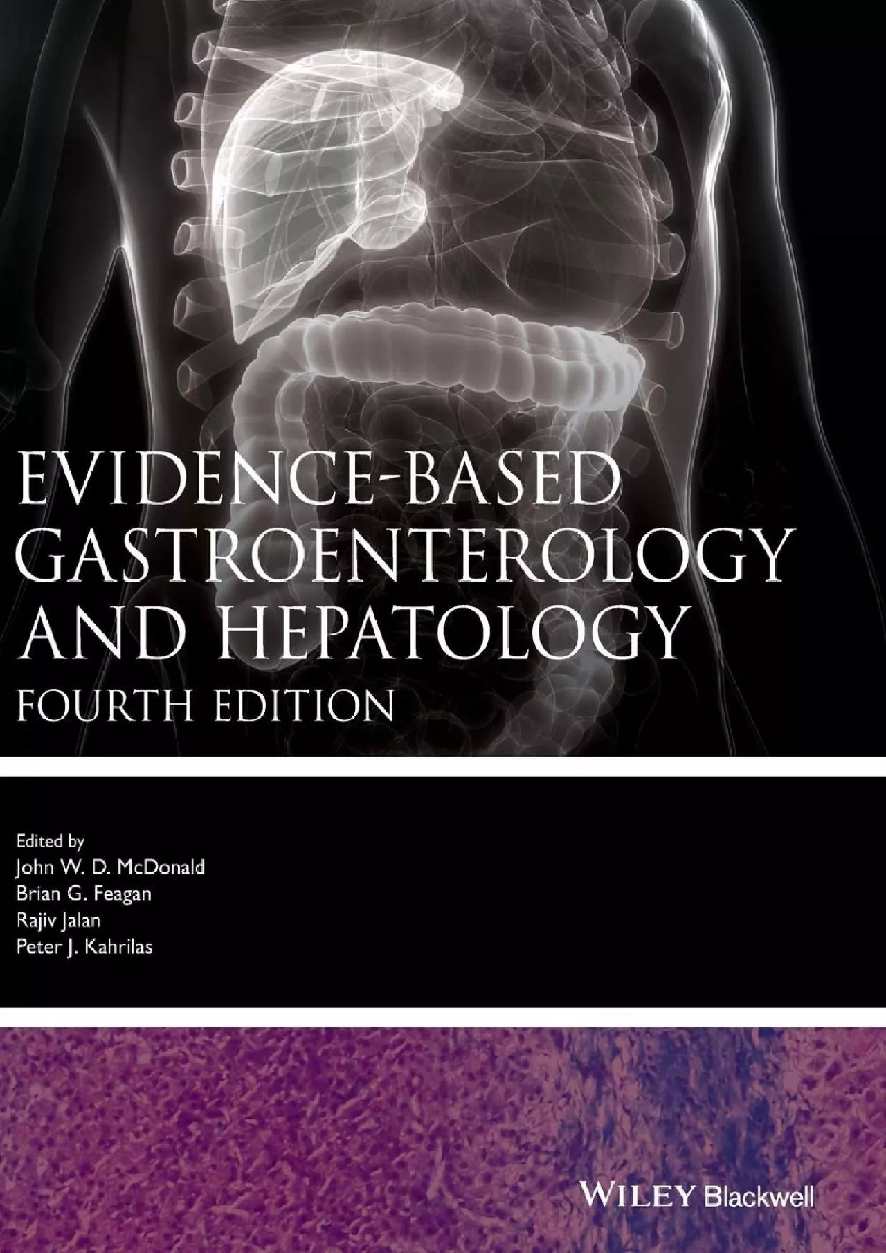 (BOOK)-Evidence-based Gastroenterology and Hepatology (Evidence-Based Medicine)