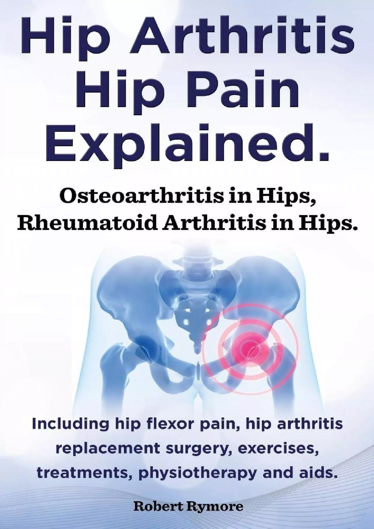 (EBOOK)-Hip Arthritis, Hip Pain Explained. Osteoarthritis in Hips, Rheumatoid Arthritis