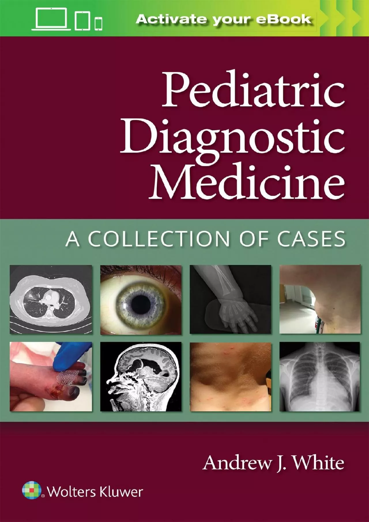 (DOWNLOAD)-Pediatric Diagnostic Medicine: A Collection of Cases