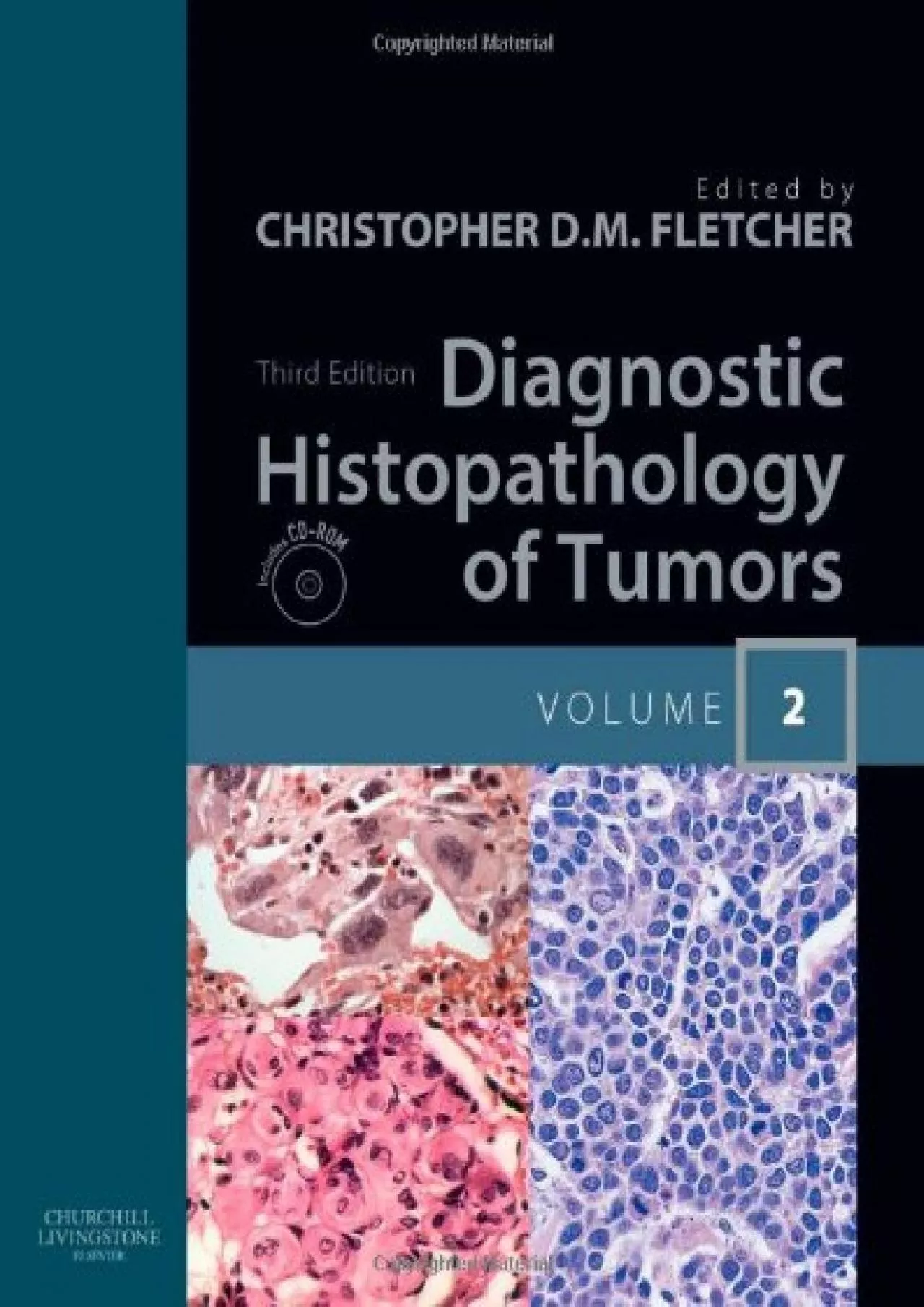 PDF-(EBOOK)-Diagnostic Histopathology of Tumors: 2-Volume Set with CD-ROMs (DIAGNOSTIC HISTOPATHOLOGY