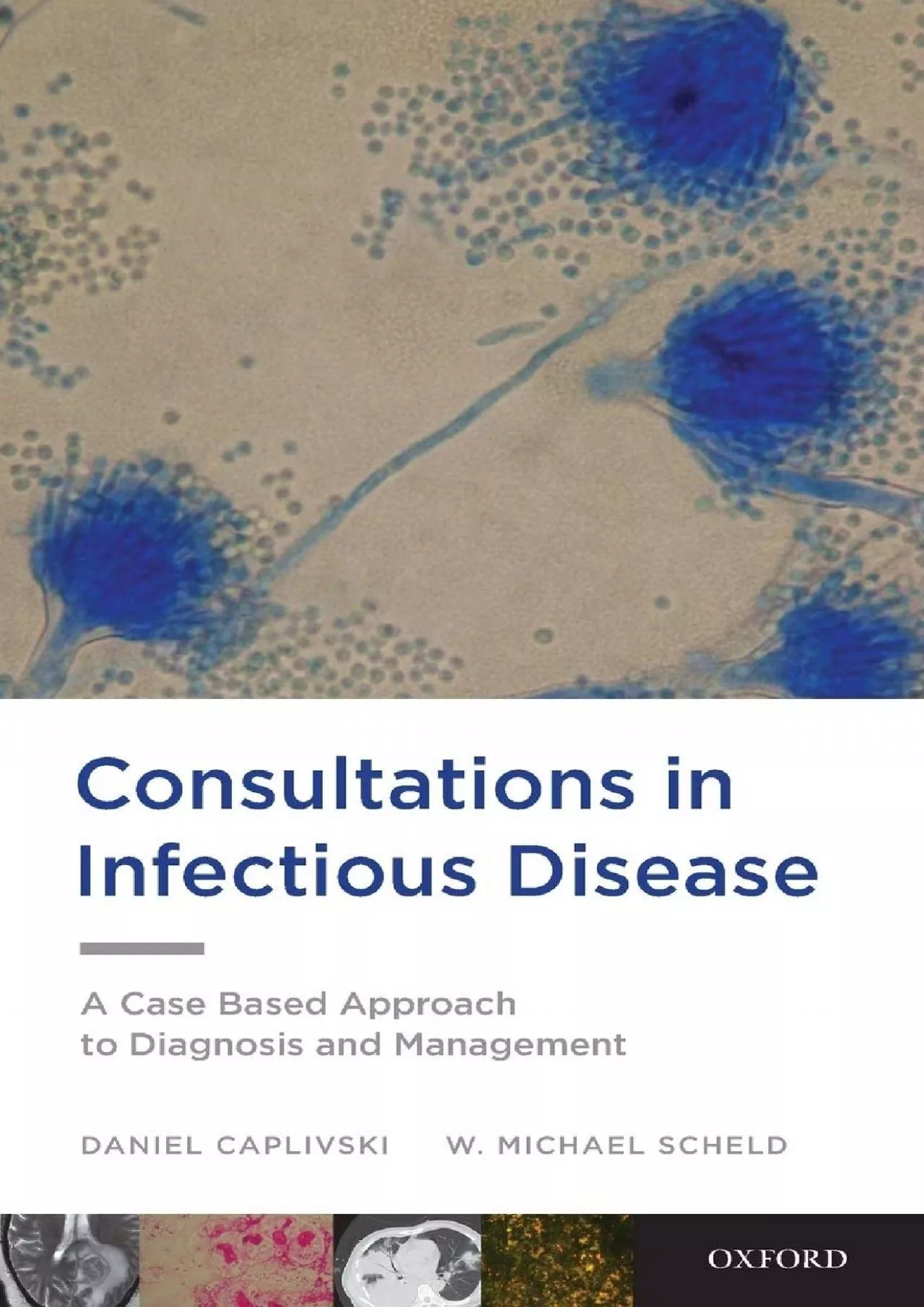 PDF-(READ)-Consultations in Infectious Disease: A Case Based Approach to Diagnosis and Management