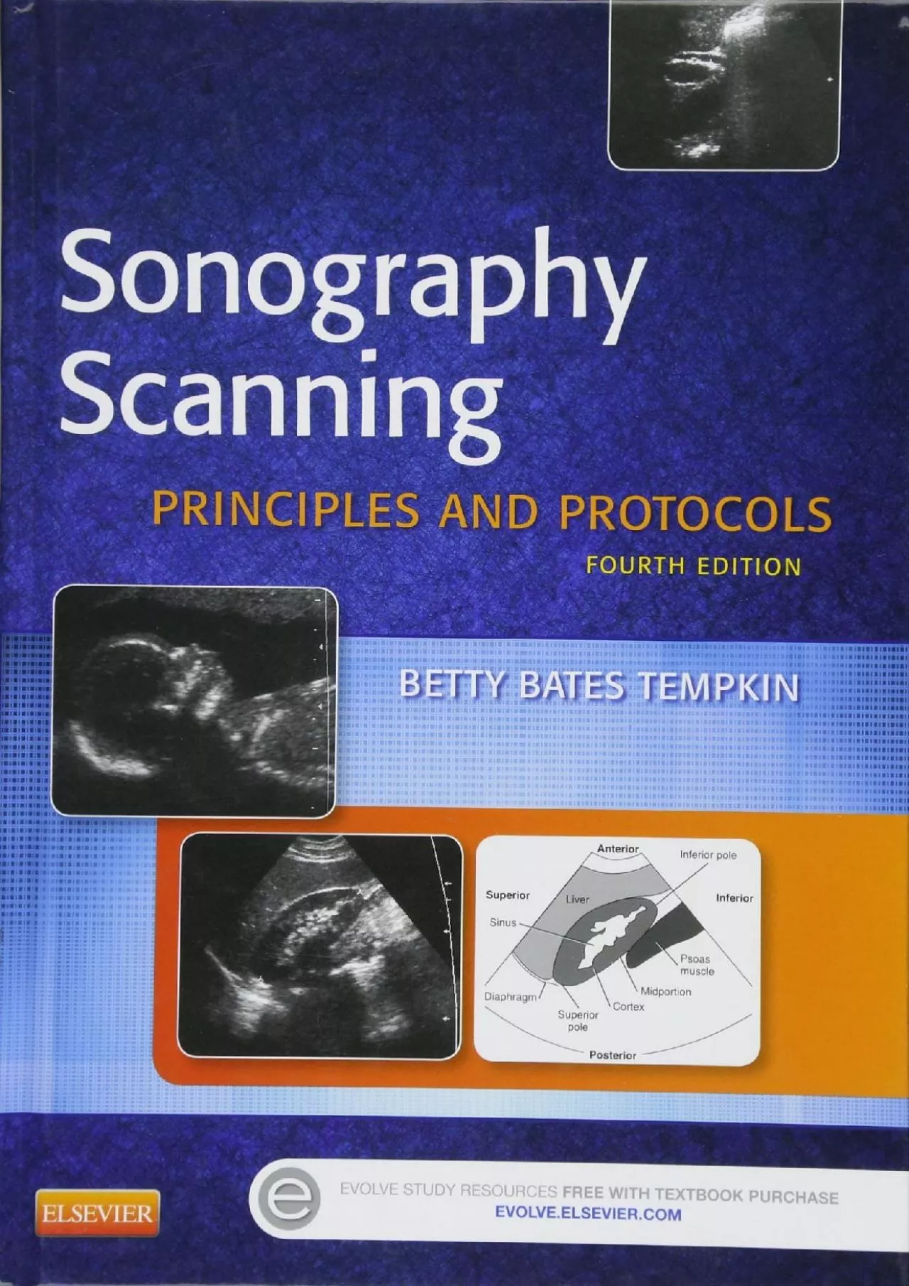 PDF-(DOWNLOAD)-Sonography Scanning: Principles and Protocols (Ultrasound Scanning)