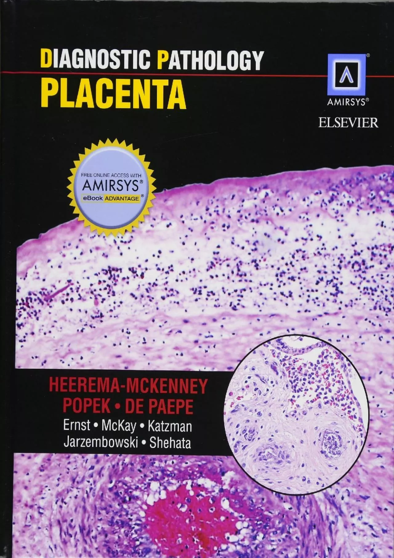 PDF-(BOOK)-Diagnostic Pathology: Placenta