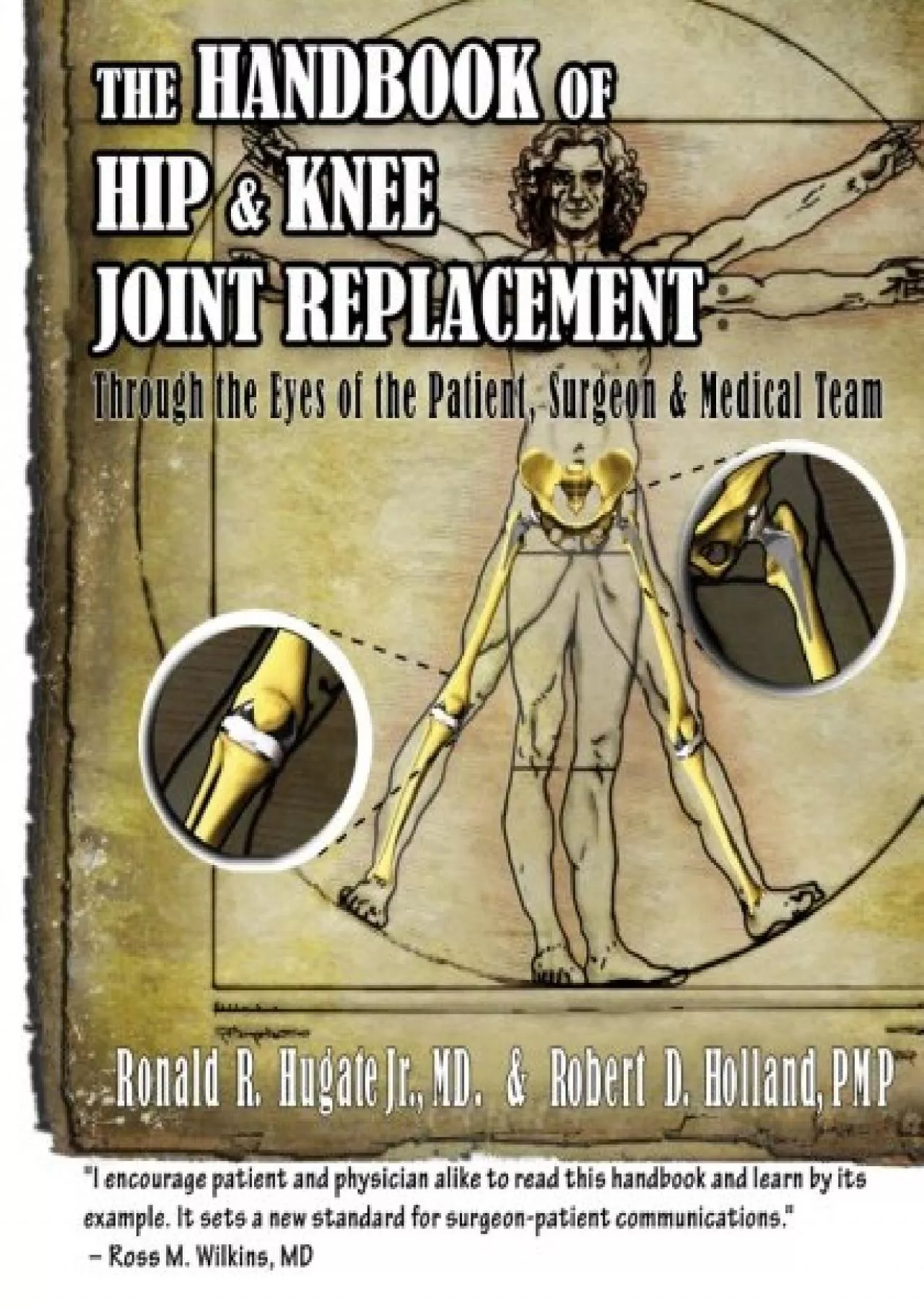 (EBOOK)-Handbook of Hip & Knee Joint Replacement: Through the Eyes of the Patient, Surgeon