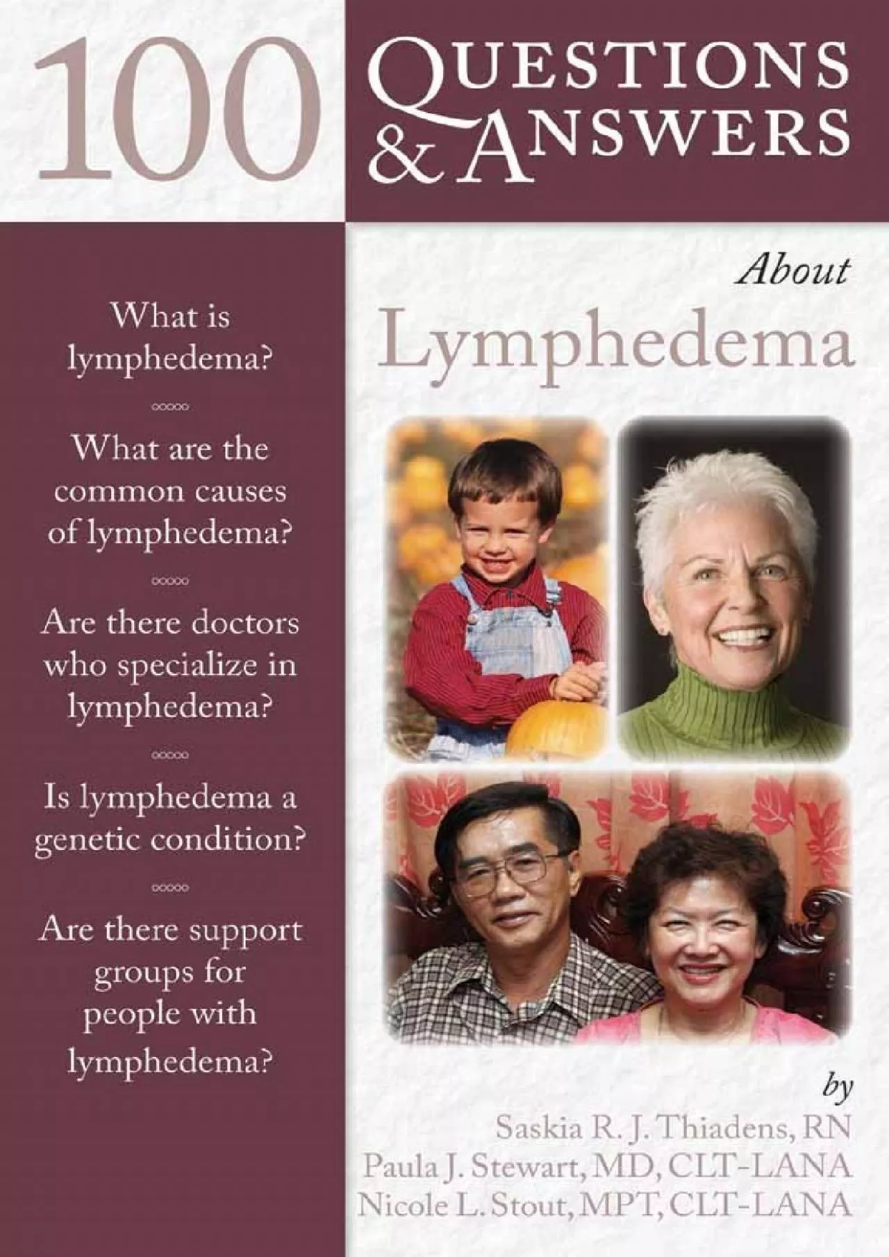 PDF-(DOWNLOAD)-100 Questions & Answers About Lymphedema