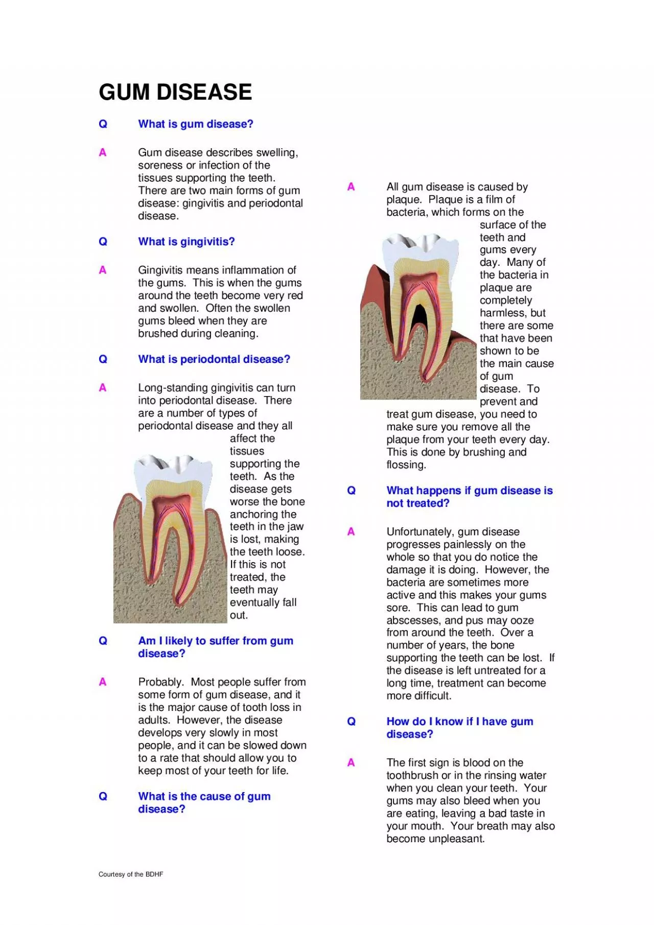 PDF-Courtesy of the BDHF