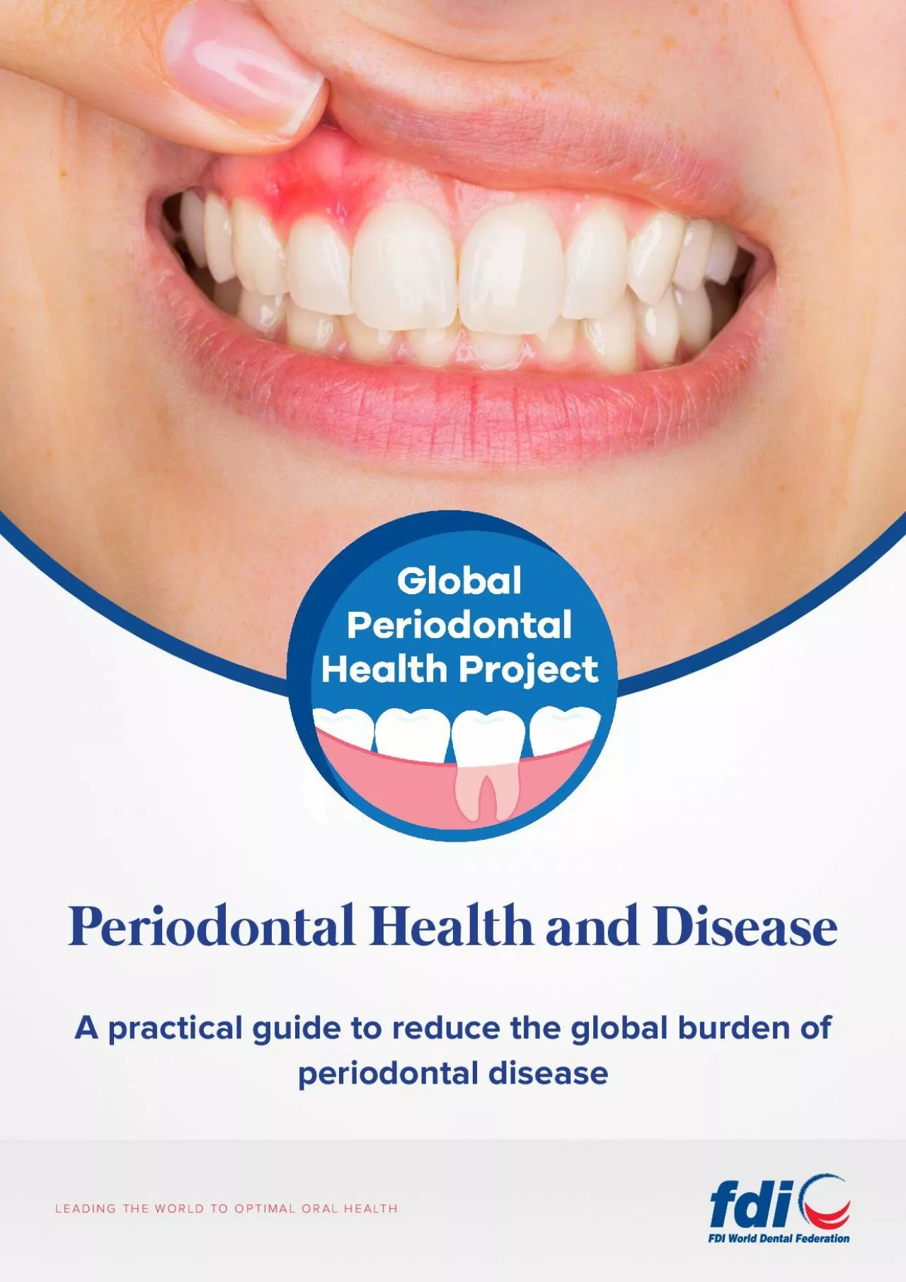 PDF-A practical guide to reduce the global burden of