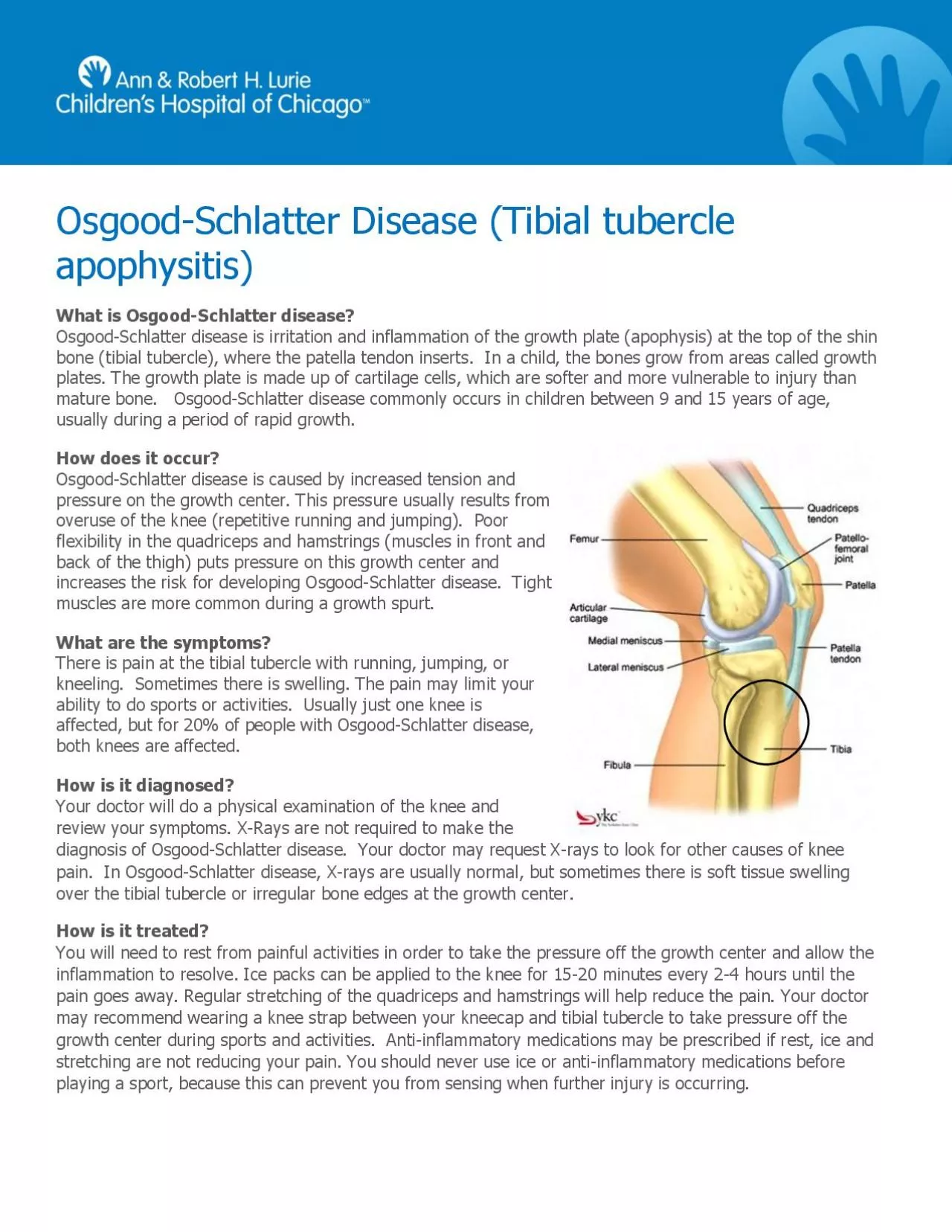 PDF-Schlatter Disease Tibial tubercle