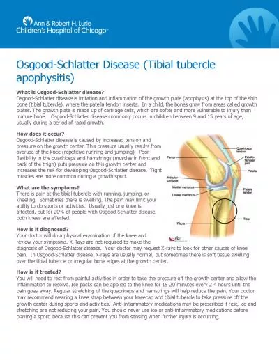 Schlatter Disease Tibial tubercle