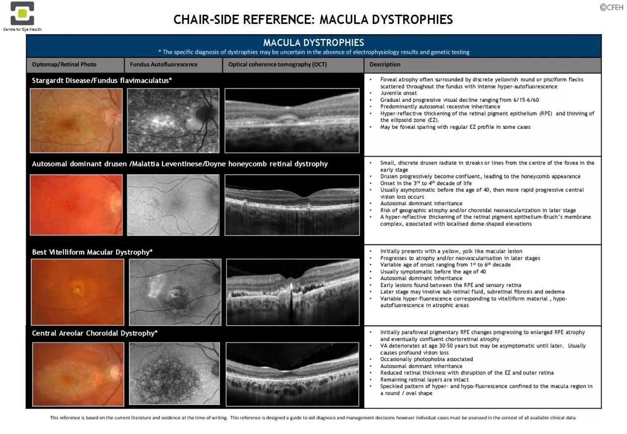 PDF-MACULA DYSTROPHIES The specific diagnosis of dystrophies may be uncer