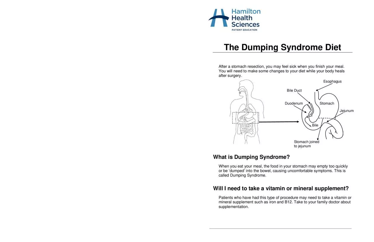 The Dumping Syndrome Diet