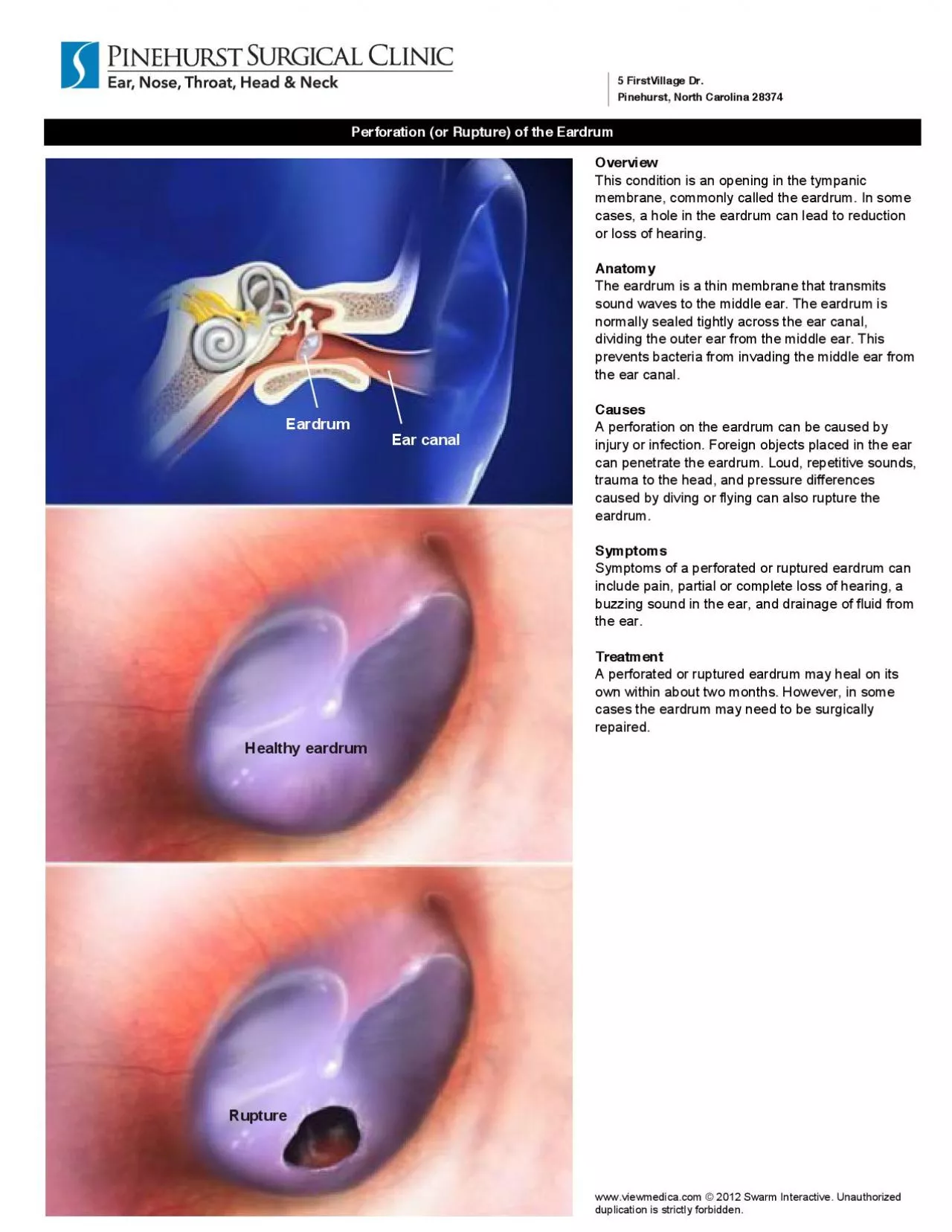 PDF-Healthy eardrumRuptureEar canalEardrum