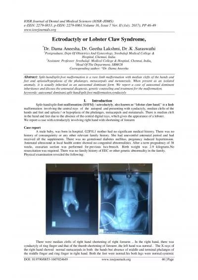 PDF-IOSR Journal of Dental and Medical Sciences IOSR