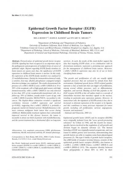 AA anaplastic astrocytoma GBM glioblastomamultiforme MoAB monoclo