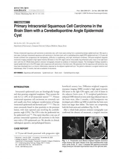 Intracranial epidermoid cysts are histologically benignand slow growin