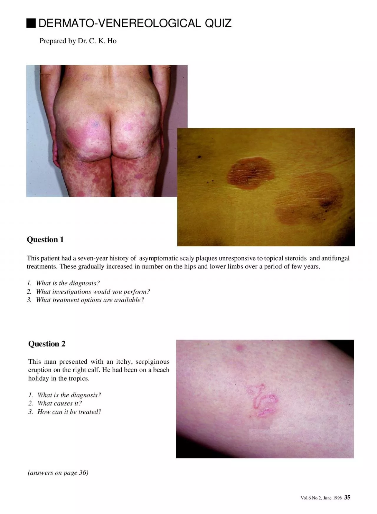 PDF-Vol6 No2 June 1998DERMATOVENEREOLOGICAL QUIZ