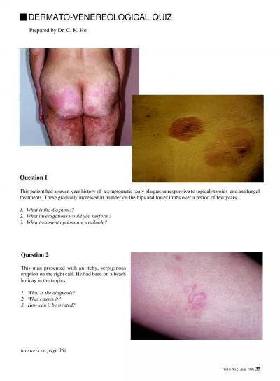 Vol6 No2 June 1998DERMATOVENEREOLOGICAL QUIZ