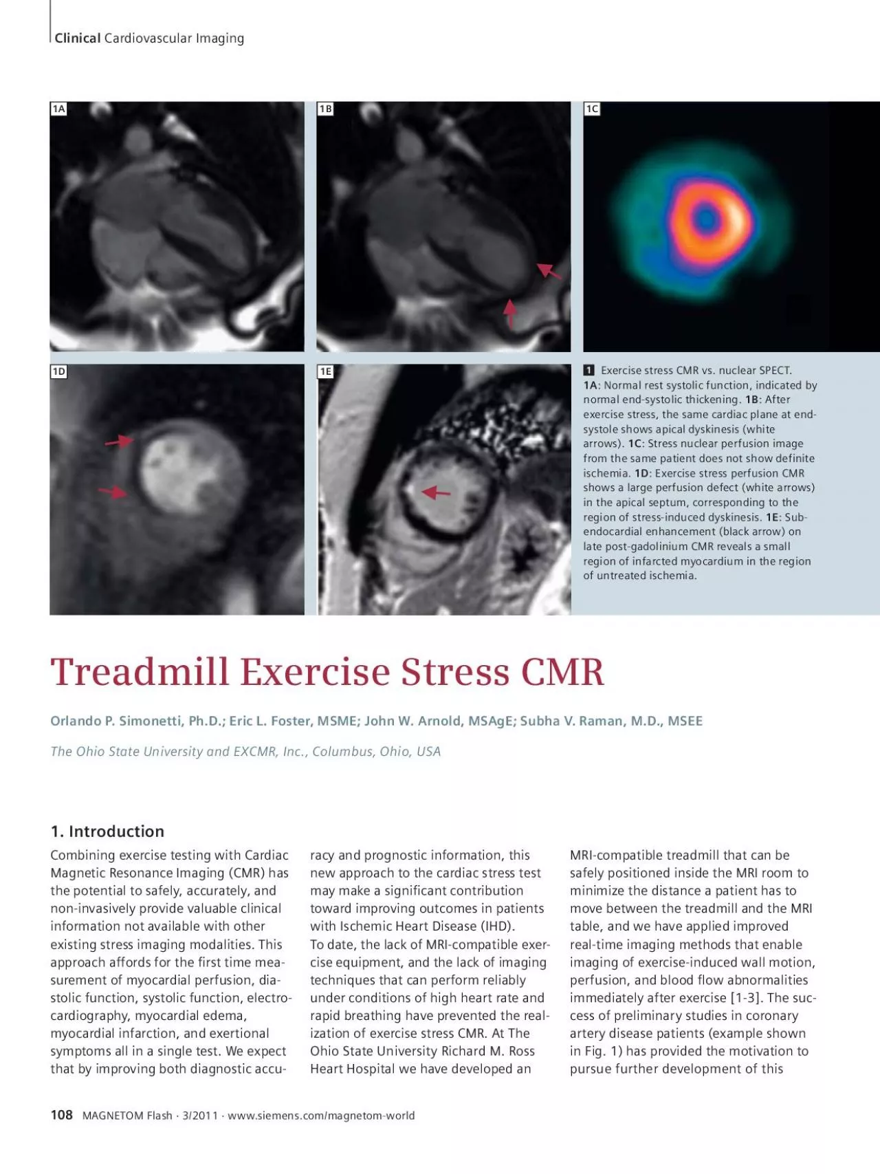 PDF-Exercise stress CMR vs nuclear SPECT Normal rest systolic function