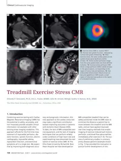 Exercise stress CMR vs nuclear SPECT  Normal rest systolic function