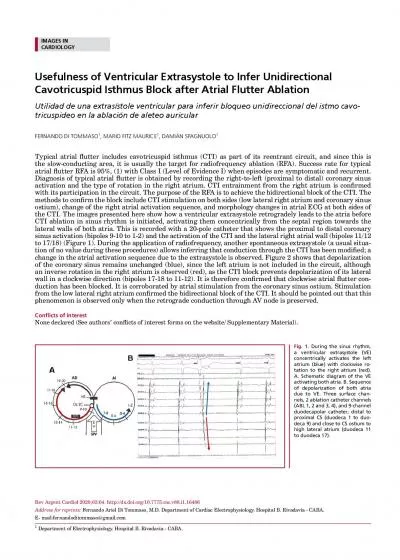 Usefulness of Ventricular Extrasystole to Infer Unidirectional Cavotri