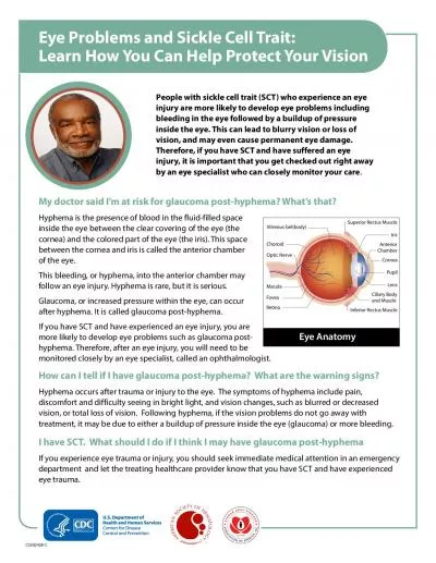 Eye Problems and Sickle Cell Trait