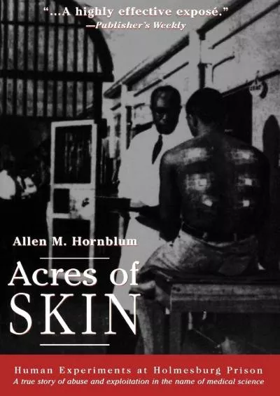 [EBOOK]-Acres of Skin: Human Experiments at Holmesburg Prison