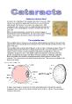 PDF-Cataracts what are they A cataract is a clouding of the norma a visu