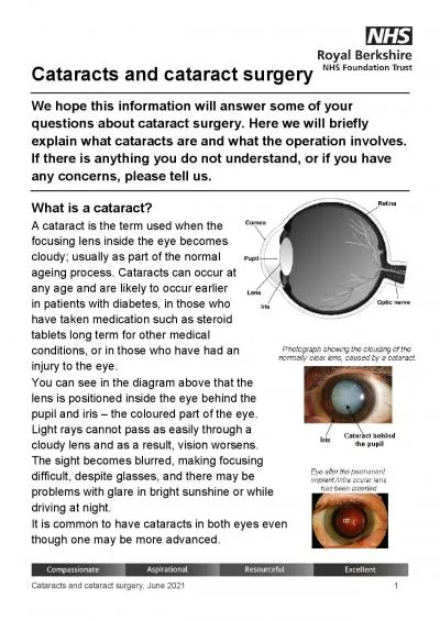 Cataracts and cataract surgery