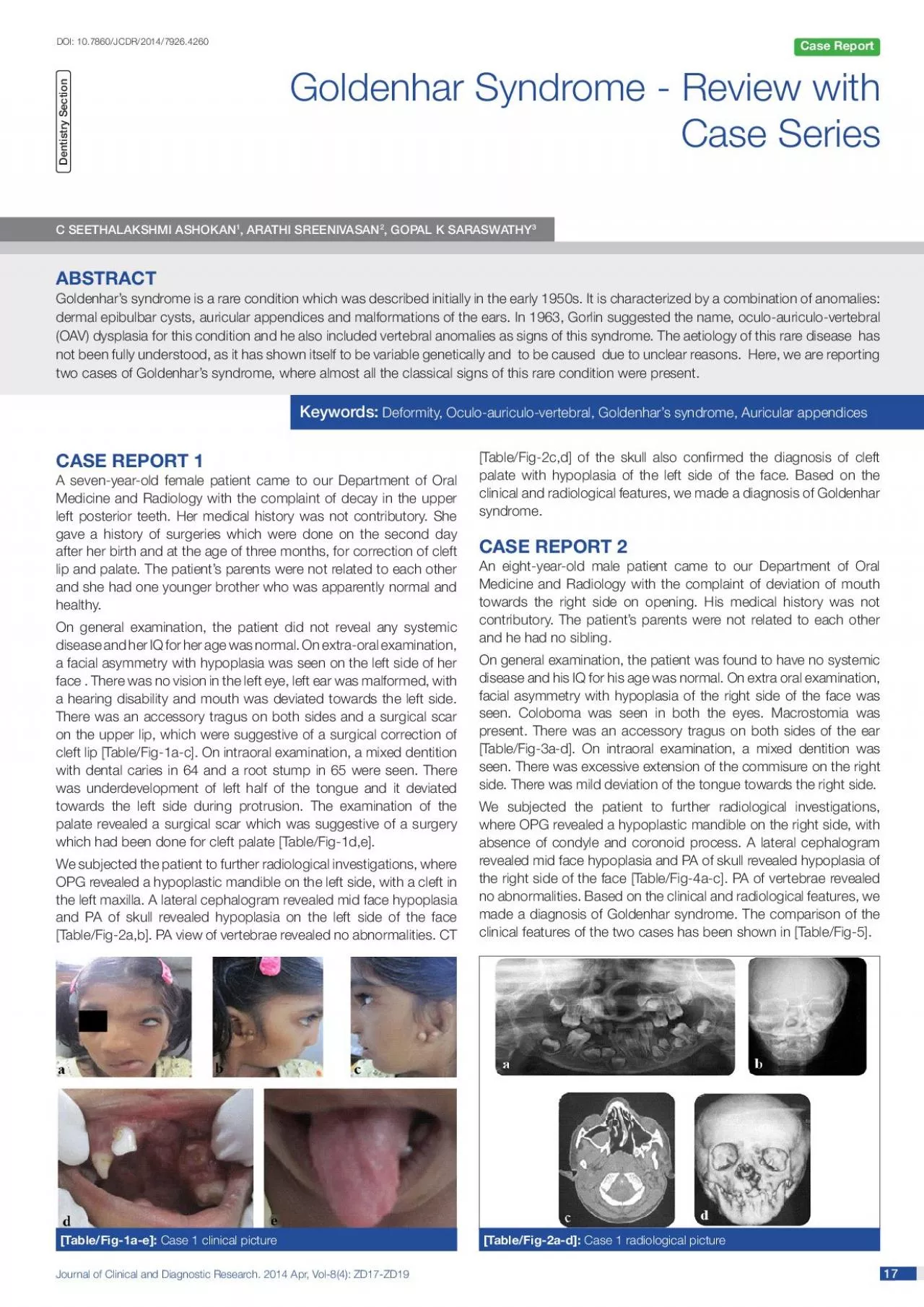 PDF-Journal of Clinical and Diagnostic Research 2014 Apr Vol84 ZD17