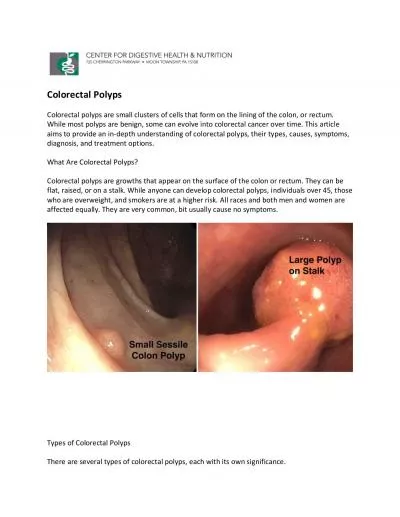 What.Is.A.Colon.Polyp.pdf