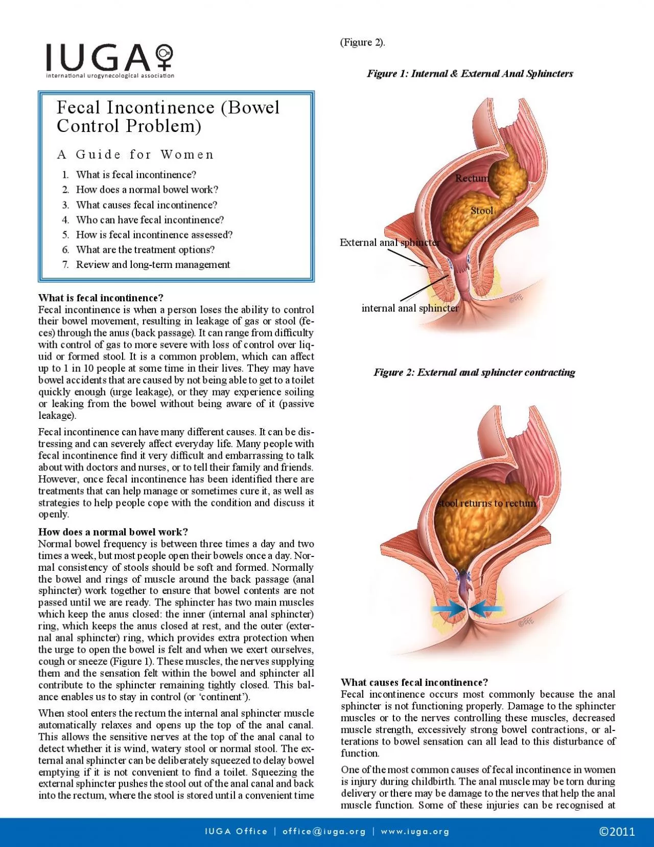 Fecal Incontinence Bowel Control ProblemA Guide for WomenWhat is fec