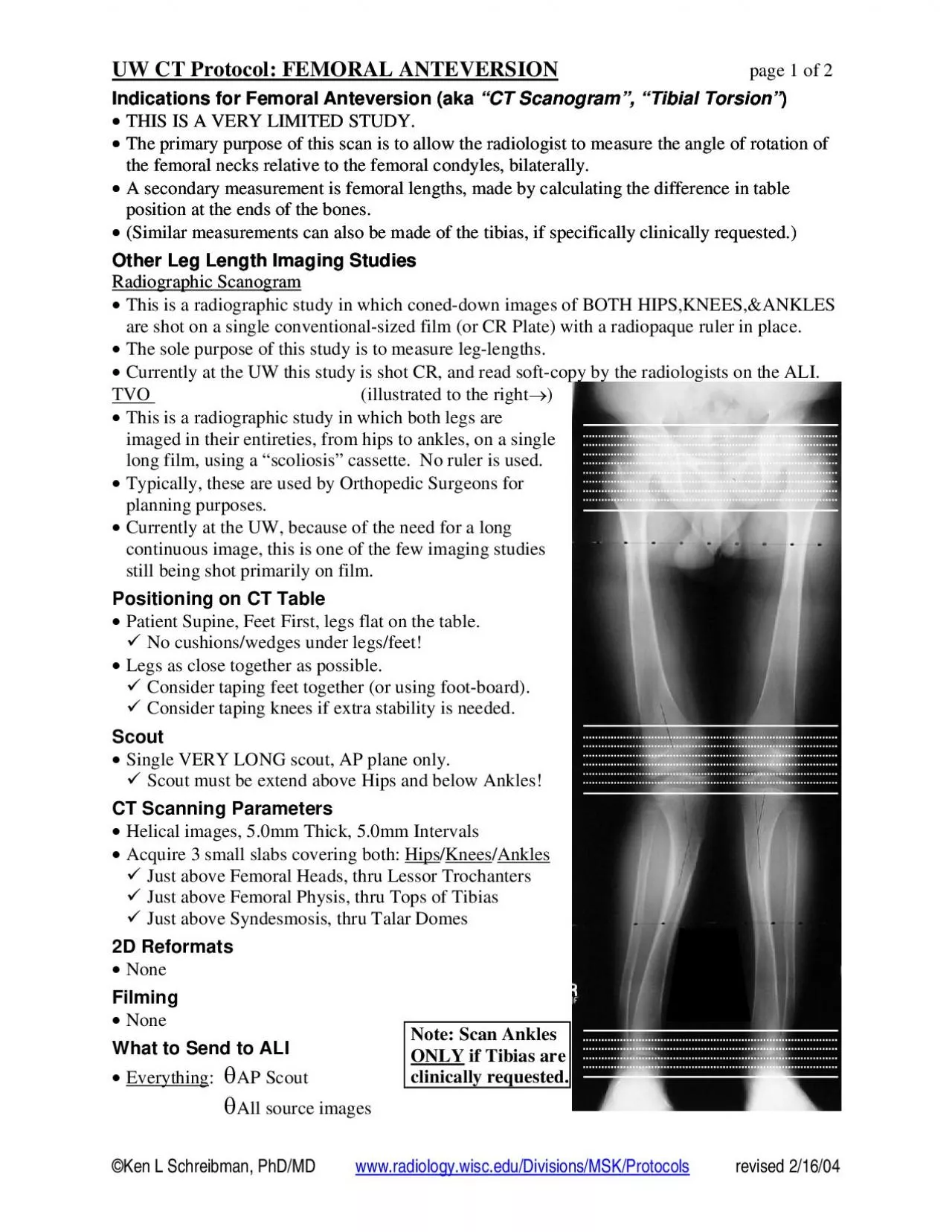 PDF-UW CT Protocol FEMORAL ANTEVERSION